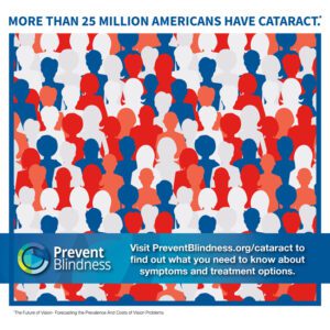 More than 25 Million Americans Have Cataract