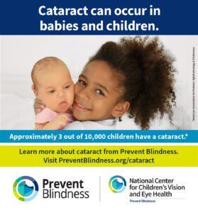 Cataract can occur in babies and children.