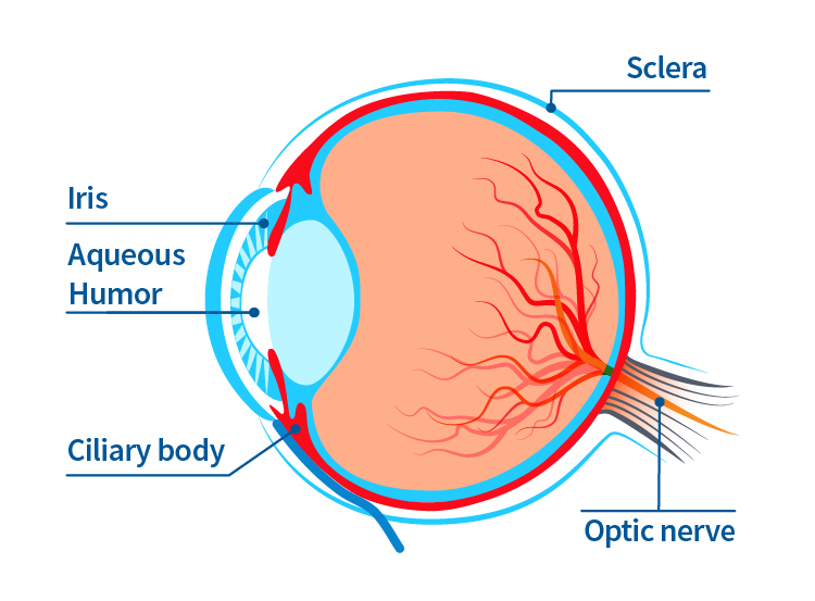 a diagram of the eye with labels for the iris, aqueous humor, the ciliary body, the sclera, and the optic nerve. Aqueous humor and the optic nerve can be affected in individuals with glaucoma