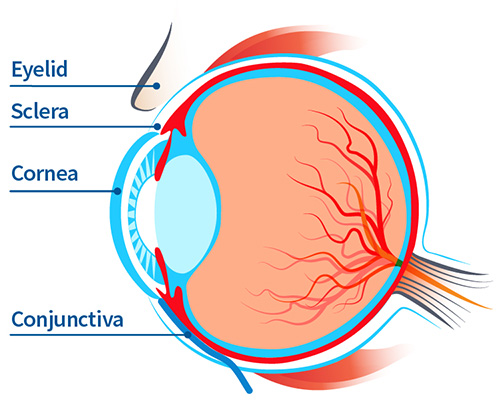 anatomy of the human eye relevant to viral conjunctivitis (pink eye), emphasizing areas such as eyelid, sclera, cornea and conjunctiva.