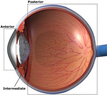 Sections of the eye and types of uveitis