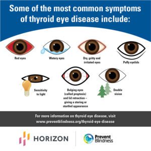 Graphic for Thyroid Eye Disease