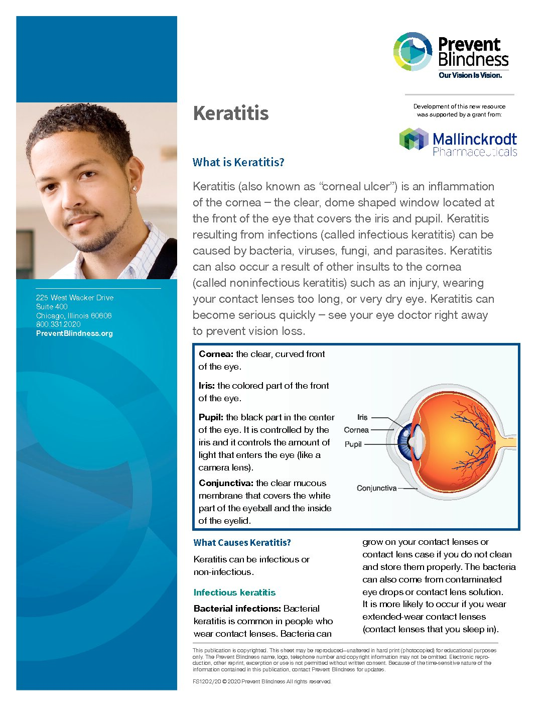 Keratitis