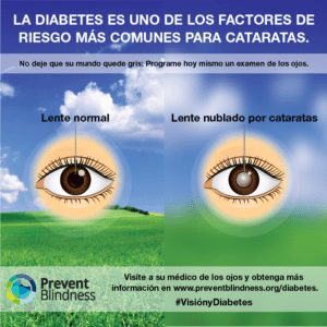 La Diabetes/cataratas