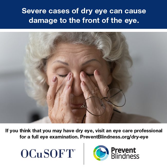 Severe cases of dry eye can cause damage to the front of the eye.