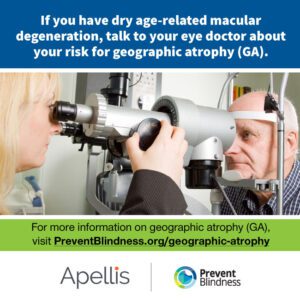 If you have dry age-related macular degeneration, talk to your eye doctor about your risk for geographic atrophy (GA)