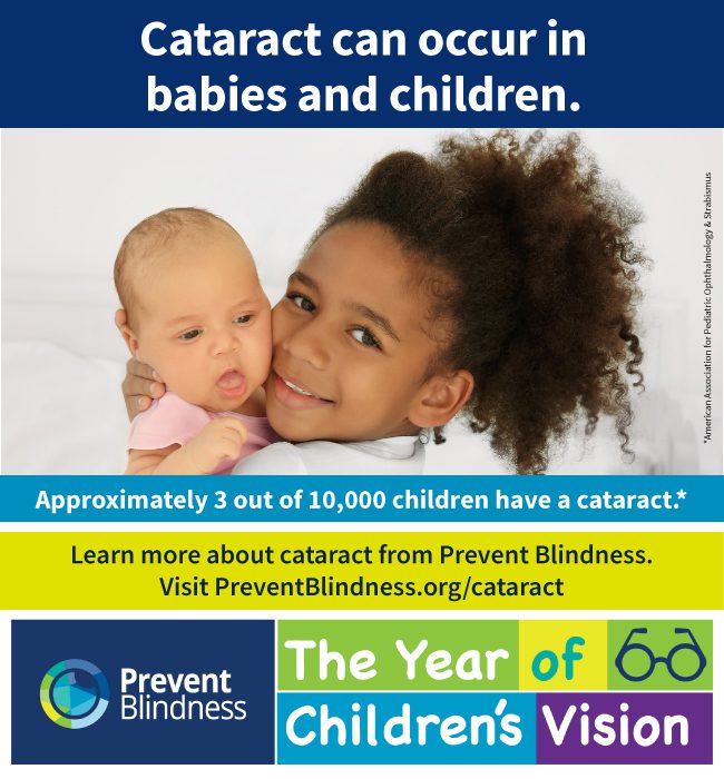 Cataract can occur in babies and children
