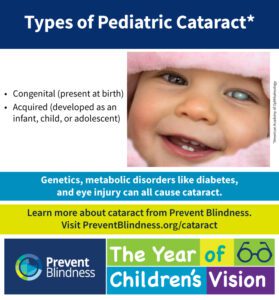 Types of pediatric cataract