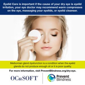 Eyelid Care is important if the cause of your dry eye is eyelid irritation.