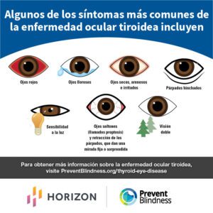 Thyroid eye disease infographic, spanish