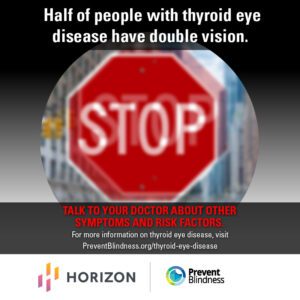 thyroid eye disease infographic,