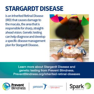 Stargardt Disease is an inherited retinal disease (IRD) that causes damage to the macula, the area that is responsible for sharp, straight-ahead vision.