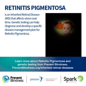 Retinitis Pigmentosa is an inherited retinal disease tat affect vision over time.