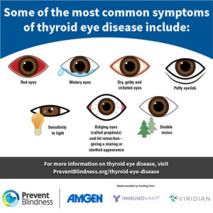 Some of the most common symptoms of thyroid eye disease.