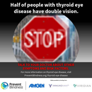 Half of people with thyroid eye disease have double vision.