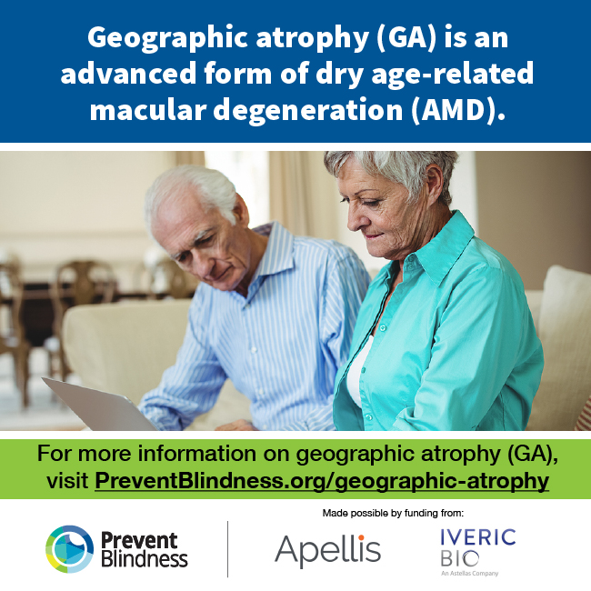 Geographic Atrophy (GA) is an advanced form of dry age-related macular degeneration (AMD)