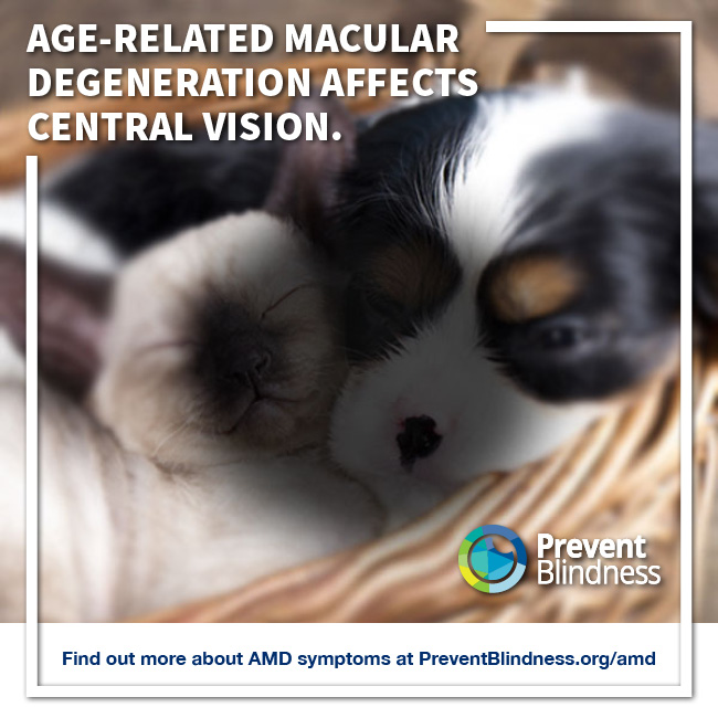 Age-related macular degeneration affects central vision.