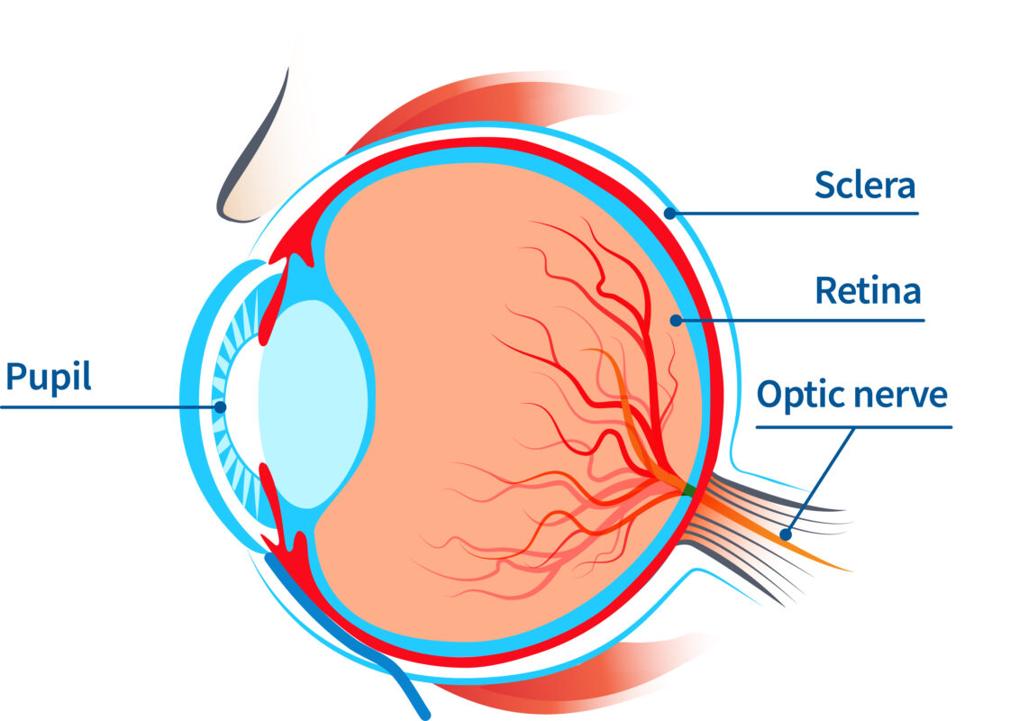  a diagram of the eye for retinopathy of prematurity, showing the pupil, sclera, retina, and optic nerve