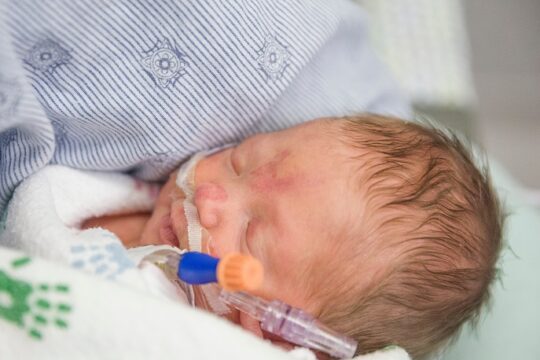 retinopathy of prematurity and your child's lifelong vision health