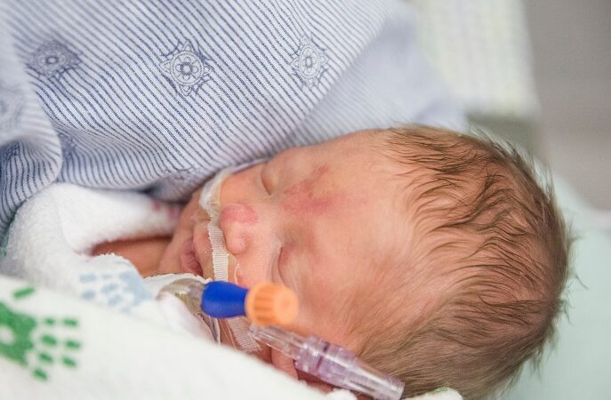 retinopathy of prematurity and your child's lifelong vision health