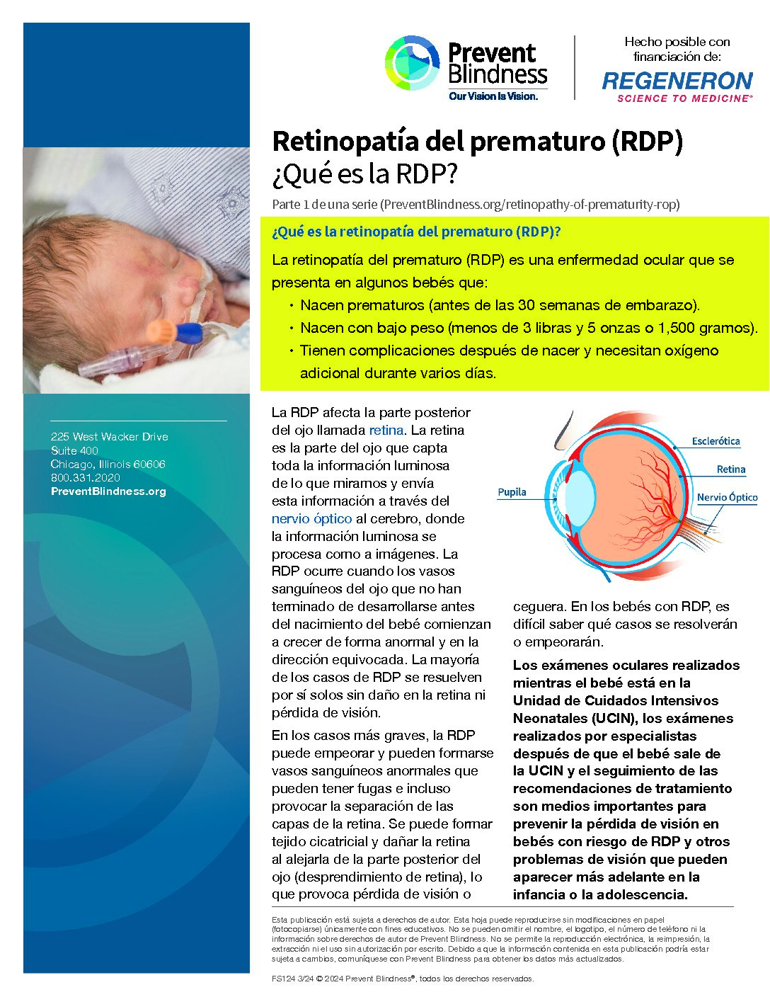 Retinopatía del prematuro (RDP)