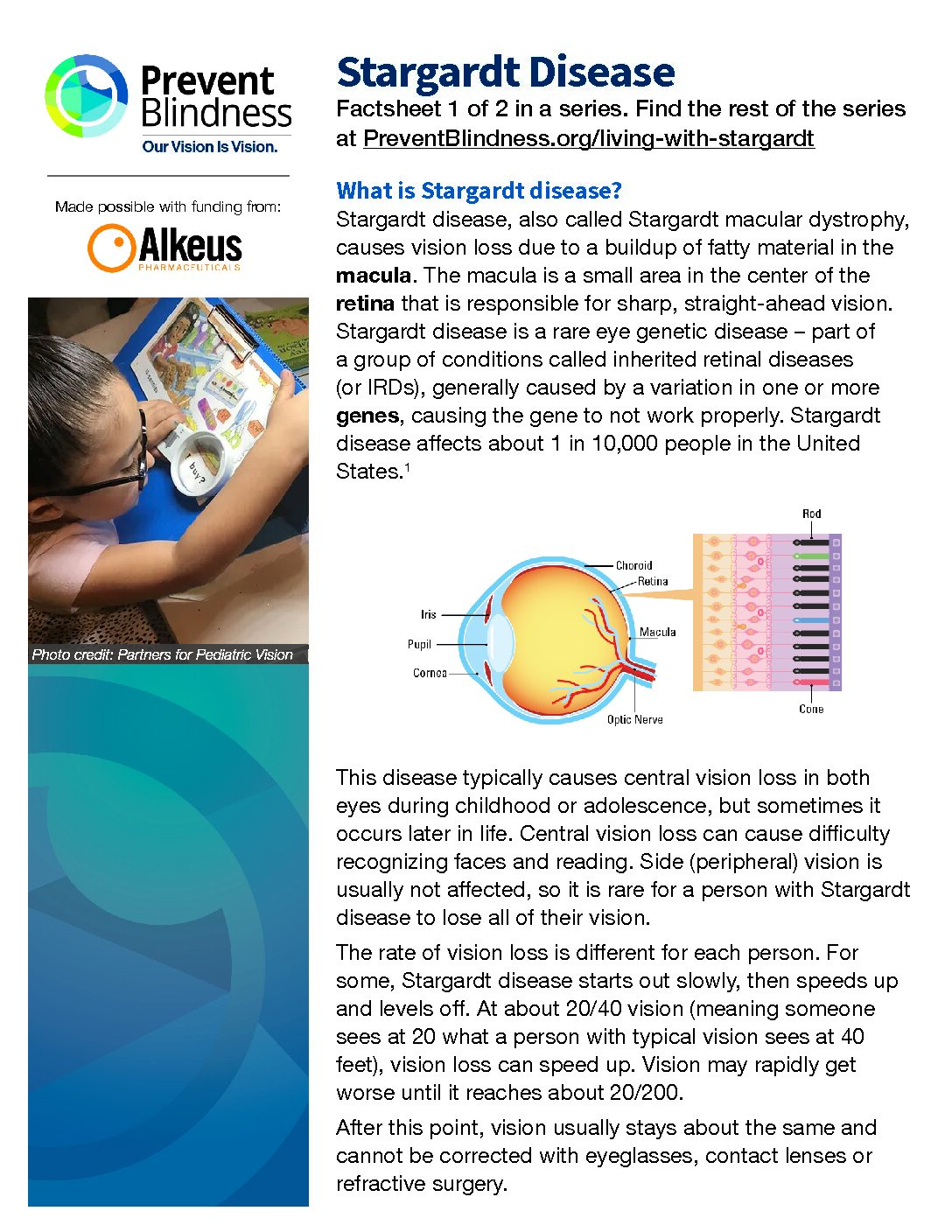 Stargardt Disease