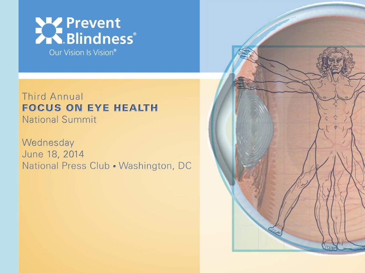 Projections for the Prevalence and Cost of Vision Problems