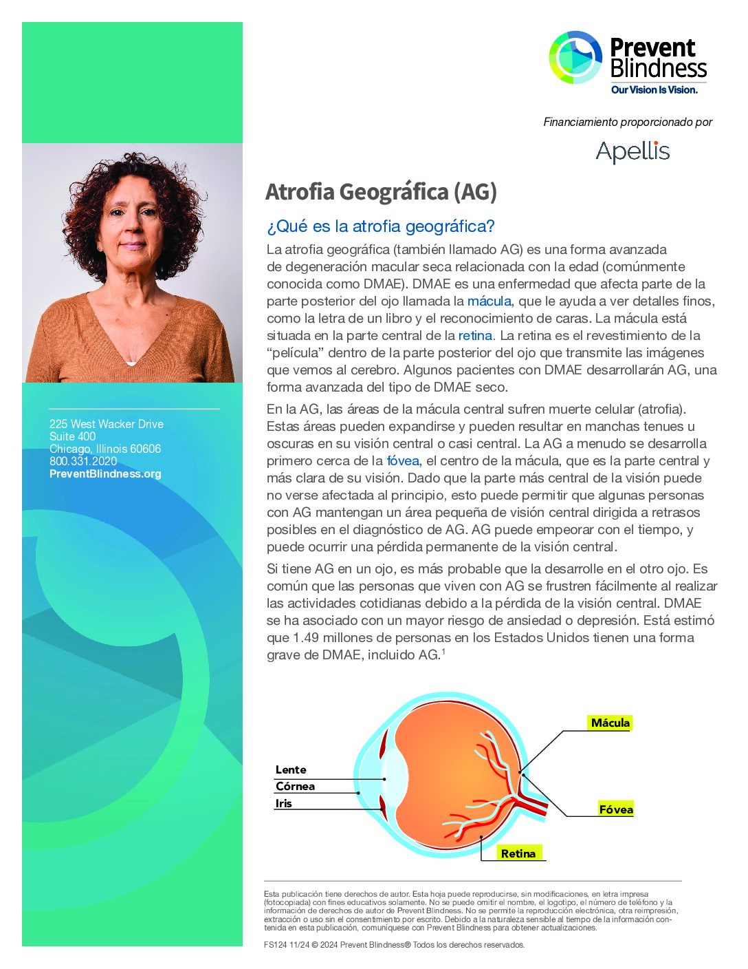 Atrofia Geográfica (GA)