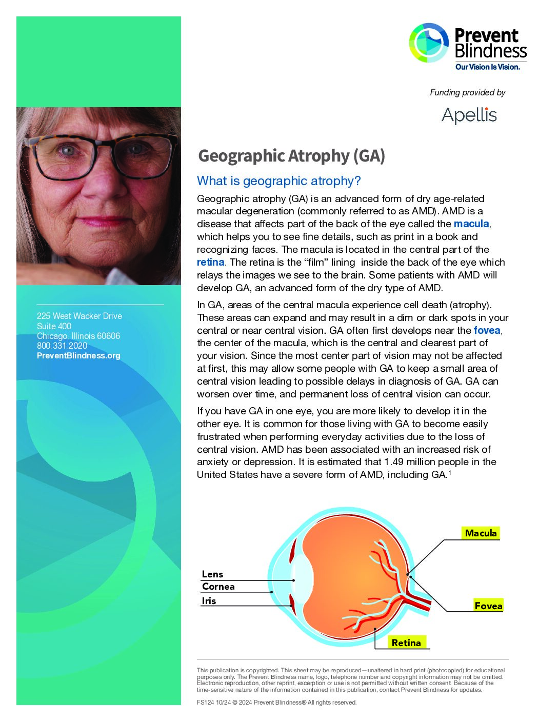 Geographic Atrophy (GA)