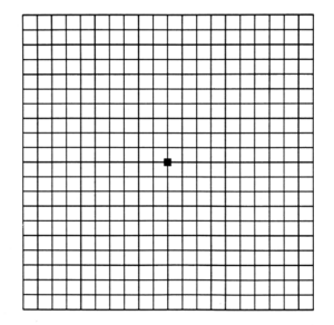 A normal Amsler Grid