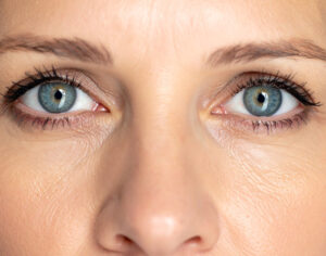 Prevent Blindness Declares Sixth Annual Thyroid Eye Disease (TED) Week to Educate Public on Condition That Can Threaten Sight and Mental Wellness