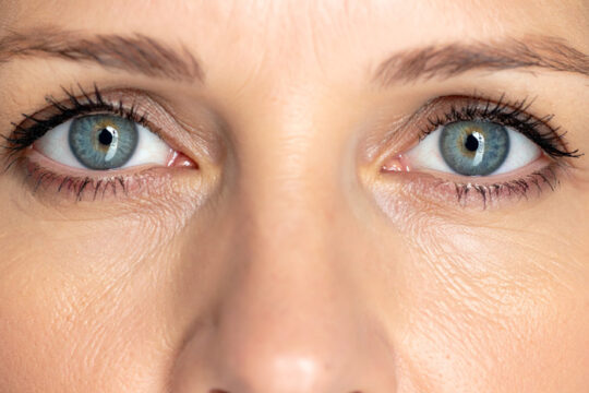 Thyroid Eye Disease: Can I Talk About My Eyes?