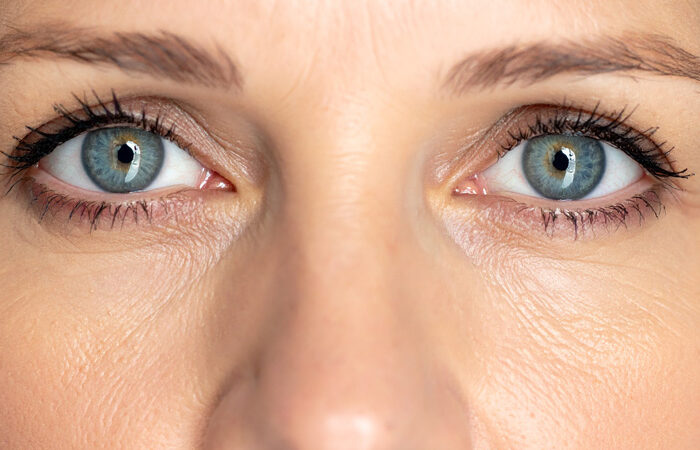 Thyroid Eye Disease: Can I Talk About My Eyes?