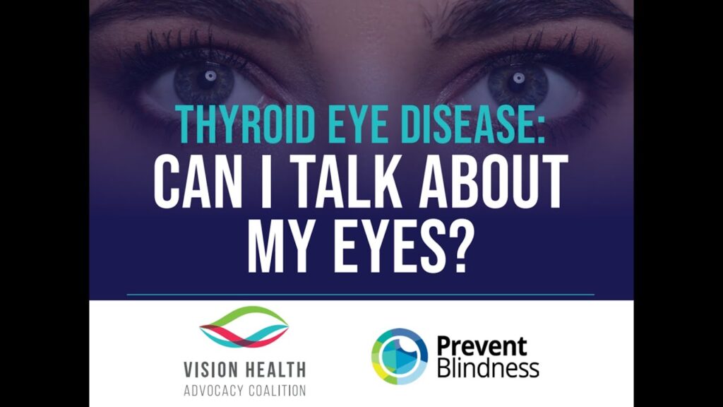 Thyroid Eye Disease: Can I Talk About My Eyes?