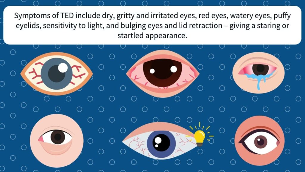 Did You Know: Thyroid Eye Disease