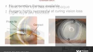 Focus on Eye Health: A National Summit - Vision Problems in the U.S.